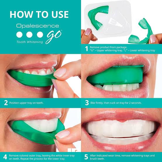 Best home teeth whitening kit